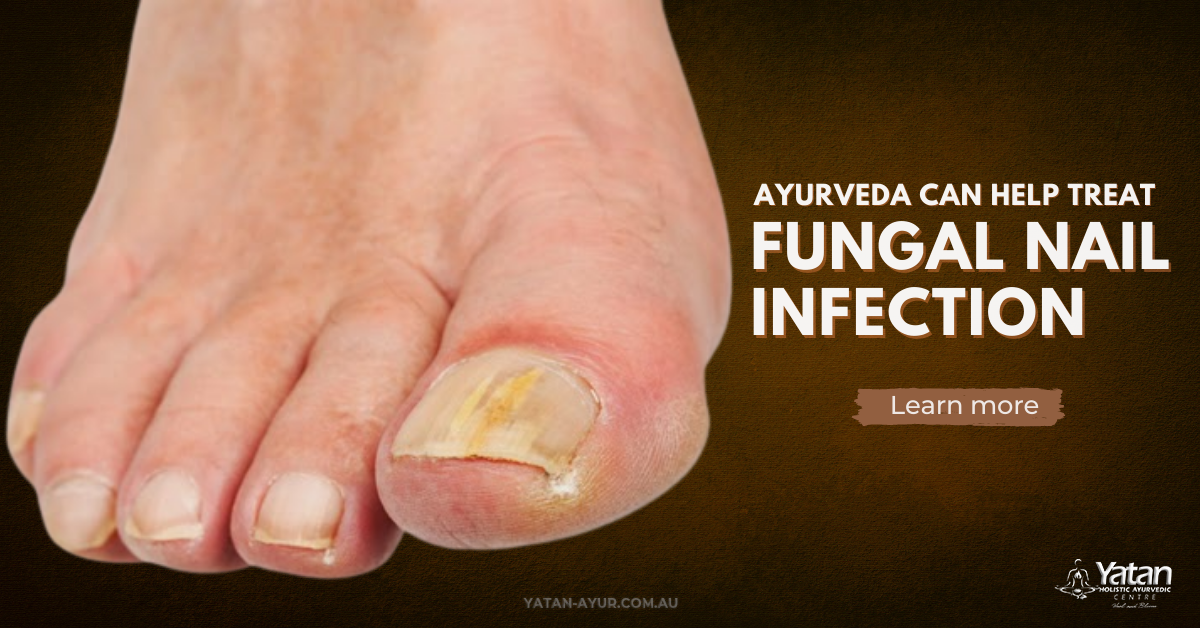 How Get Relief From Foot And Nail Fungus