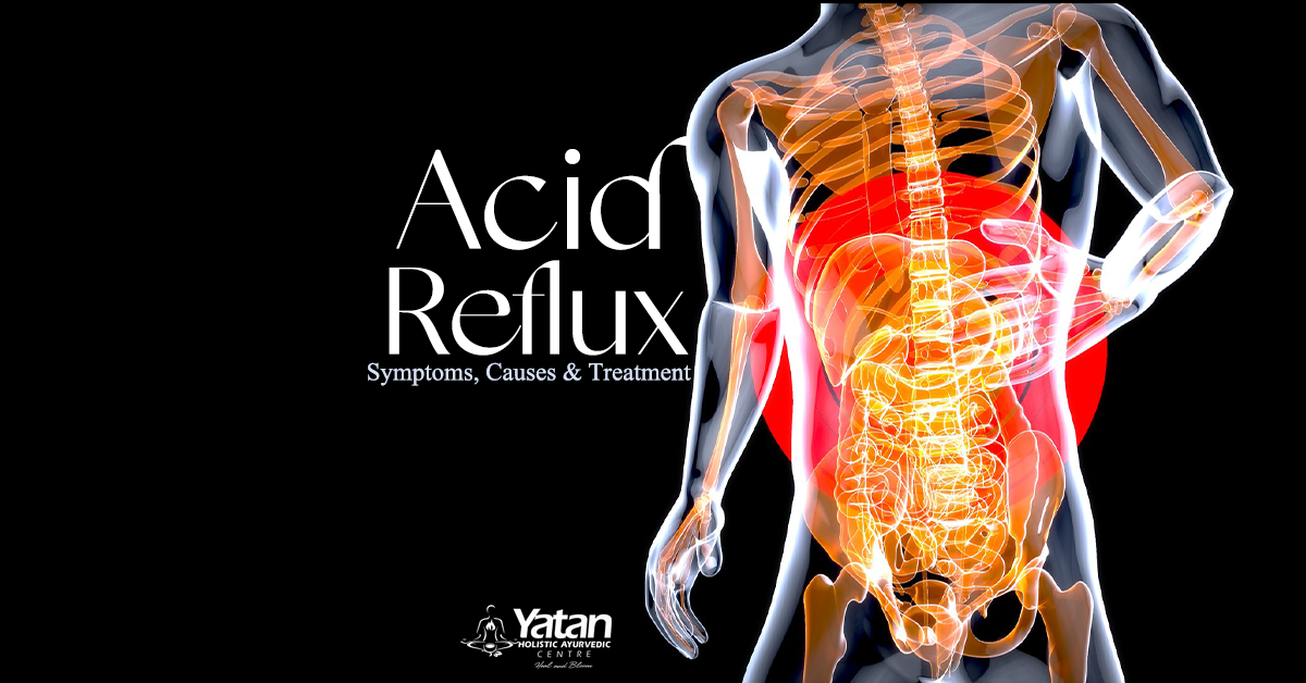 Acid Reflux Your Most FAQ Answered by an Ayurvedic Practitioner