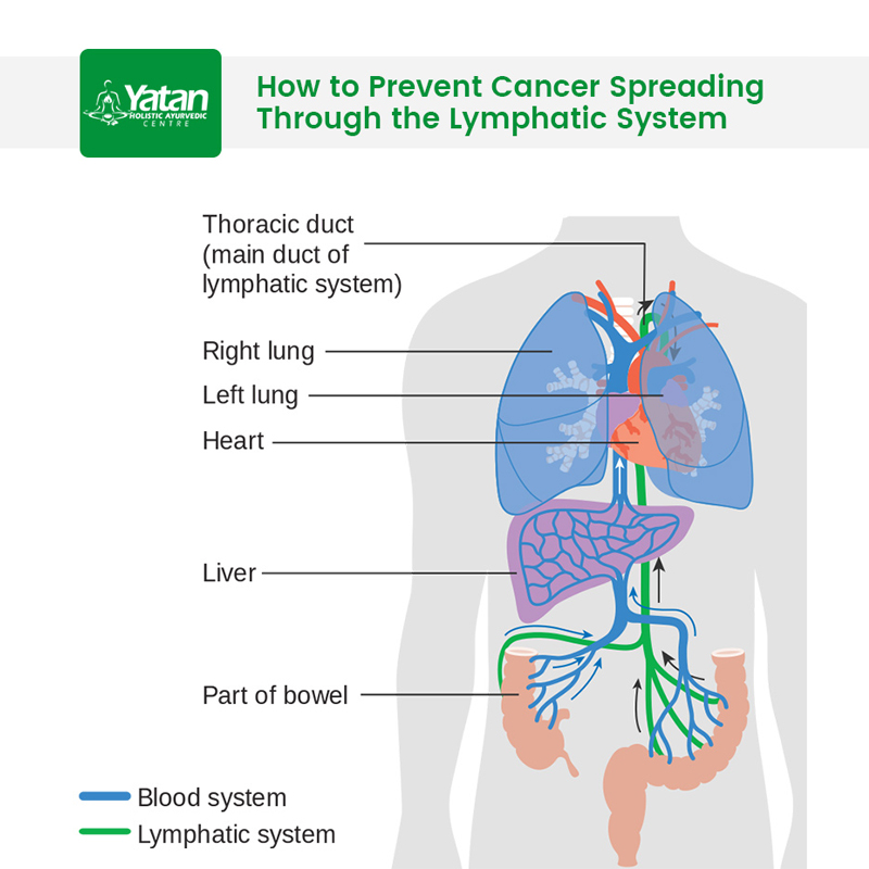 How To Prevent Cancer Spreading Through The Lymphatic System 7086